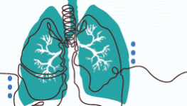 9394-fibrosing-ild-rr
